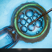 Transferencia de Embriones Vitrificados